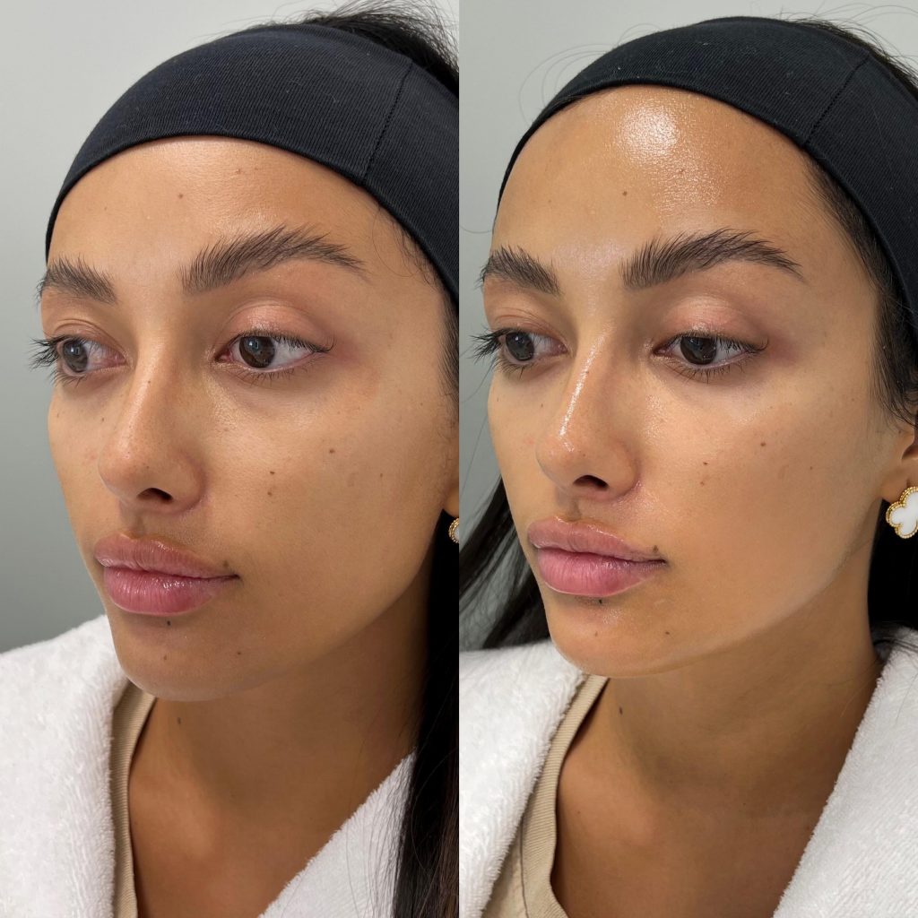 GENOSYS INTENSIVE HYDRO SOOTHING CREAM Diamond Skin