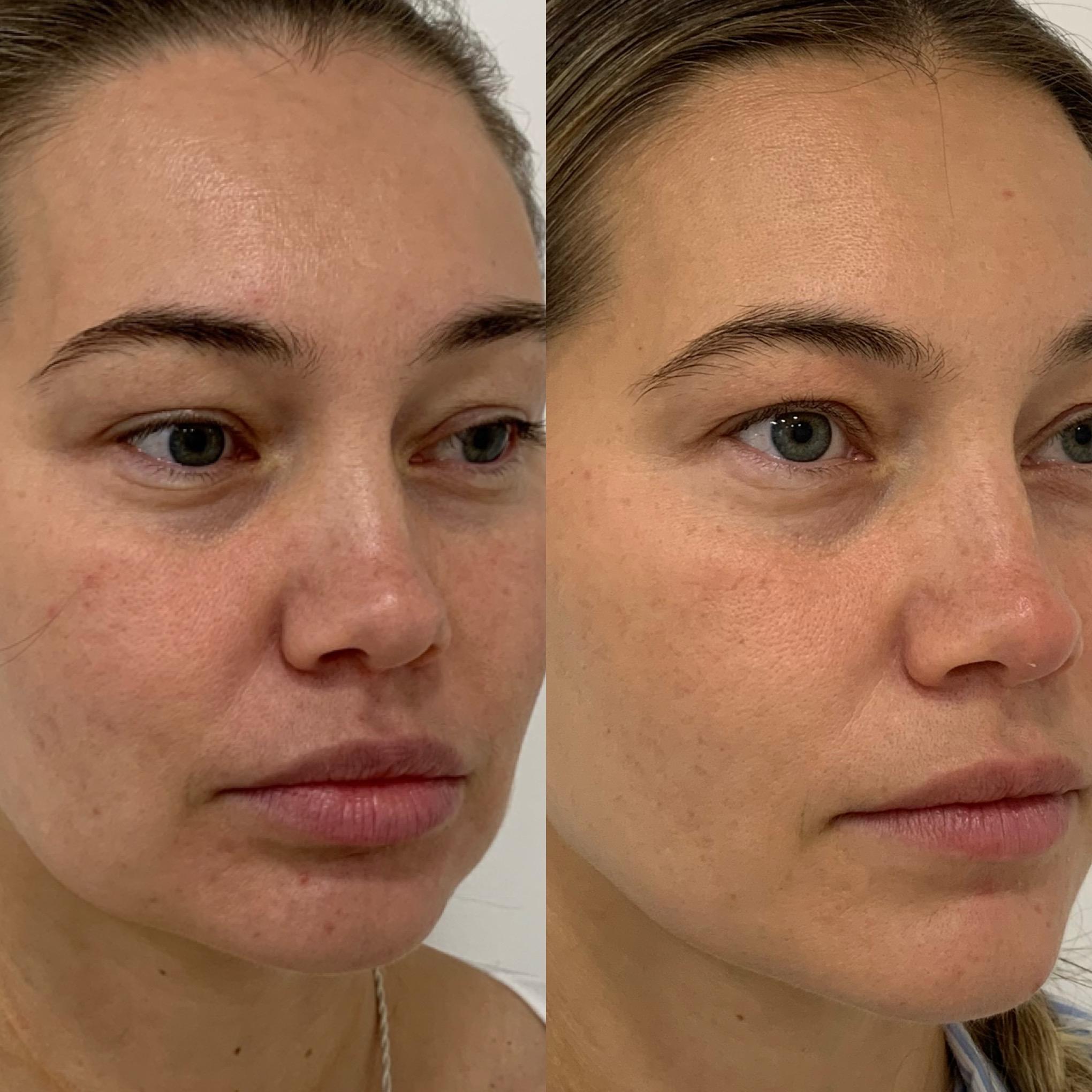 IMAGE skincare ILUMA™ INTENSE BRIGHTENING EXFOLIATING POWDER Diamond Skin